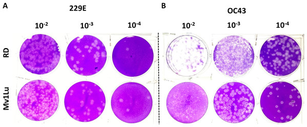 Comparison of susceptible cell lines with the improved plaque assay.
