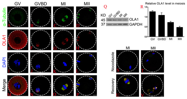 Cellular localization and expression pattern of OLA1 in mouse oocyte meiosis.