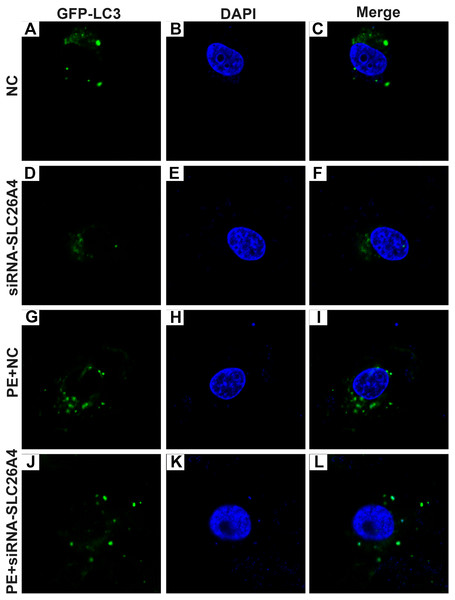 Effect of PE and siRNA-SLC26A4 on autophagy flux in H9C2 cells transfected with GFP-LC3.