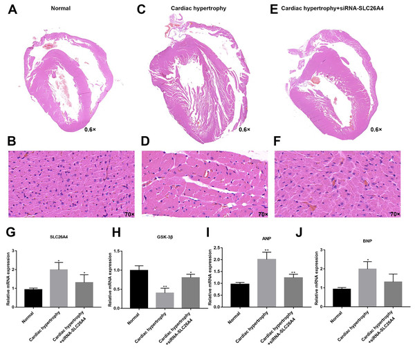 Inhibiting SLC26A4 could reverse PE-induced cardiac hypertrophy in vivo.