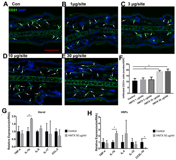 The effects of H. hainanum venom on the alterations in the microvascular density in mice and inflammatory cytokines in keratinocytes and fibroblasts.