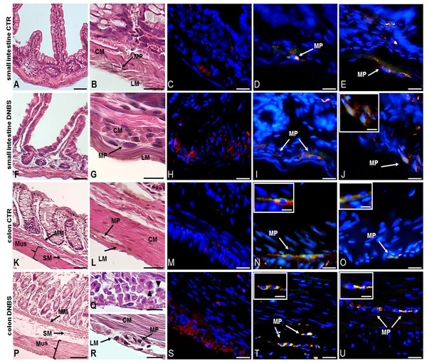 Histological evaluation, OTX1 and OTX2 staining in small intestine and colonic cross sections after DNBS-induced colitis.