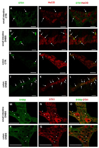 OTX1 localization in the rat small intestine and distal colon myenteric plexus of CTR and DNBS-treated rats.
