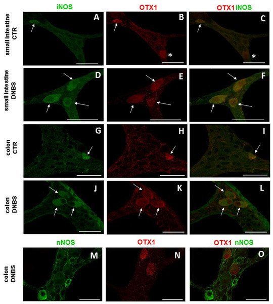 OTX1 and iNOS co-localization in the rat small intestine and distal colon myenteric plexus of CTR and DNBS-treated rats.