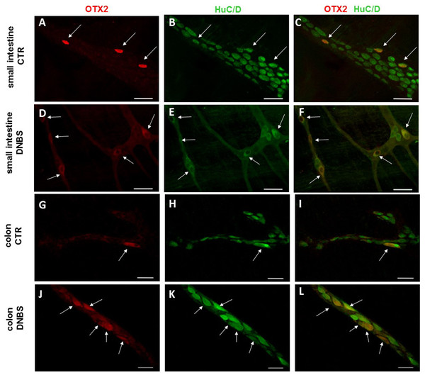OTX2 localization in the rat small intestine and distal colon myenteric plexus of CTR and DNBS-treated rats.