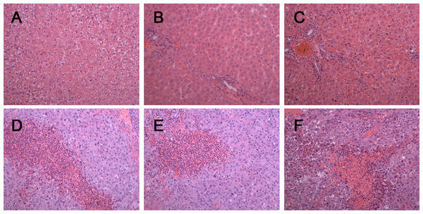 Histopathological characterization after injection with W256 cells (200X).