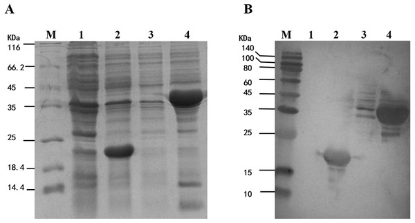 Analysis of the fusion protein Trx-His-mMpMn-SOD overexpressed in BL21 cells.