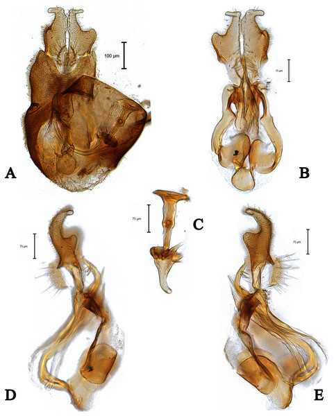 Male genitalia of Dasydorylas parazardouei Motamedinia and Skevington sp. nov. (A) in dorsal view, (B) in ventral view, (C) ejaculatory apodeme, (D and E) in lateral view.