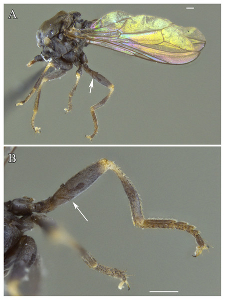 Male of Dasydorylas forcipus Motamedinia and Skevington sp. nov. (A) habitus in lateral view, (B) hind leg in anterior view.