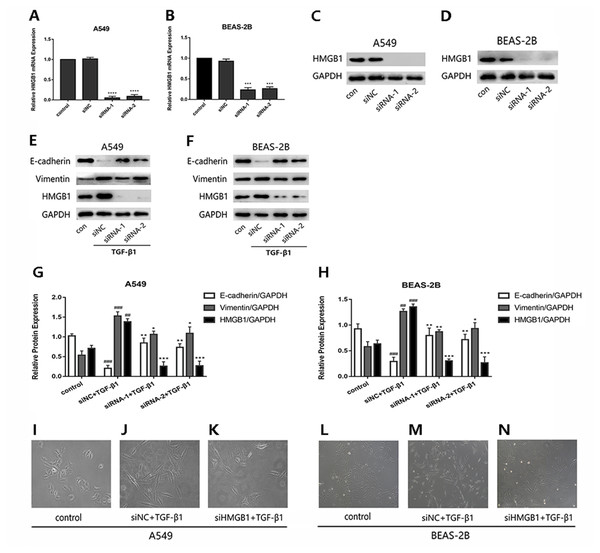 Knock down of HMGB1 reversed the TGF-β1-induced EMT in airway epithelial cells.