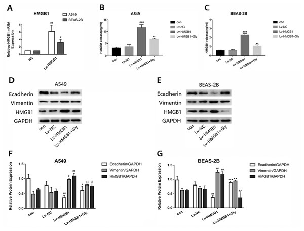 The lentivirus-mediated HMGB1 overexpression in A549 and BEAS-2B cells induced EMT, which can be inhibited by glycyrrhizin.