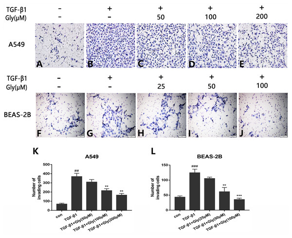 Effect of glycyrrhizin on TGF-β1-mediated cell migration of A549 and BEAS-2B cells.
