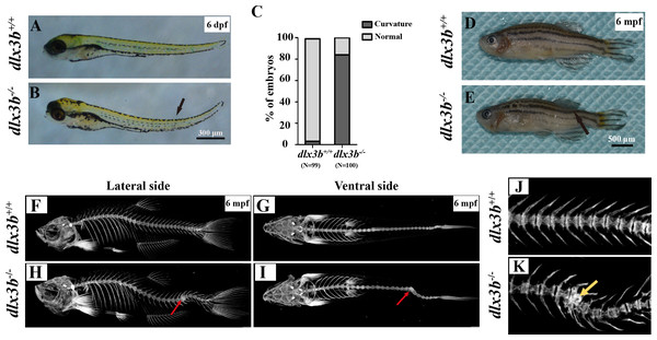 Body curvature of dlx3b homozygous mutant zebrafish.
