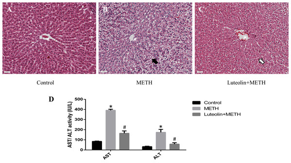 Protective effects of luteolin on liver injury caused by METH were observed by histopathology and biochemical analysis.