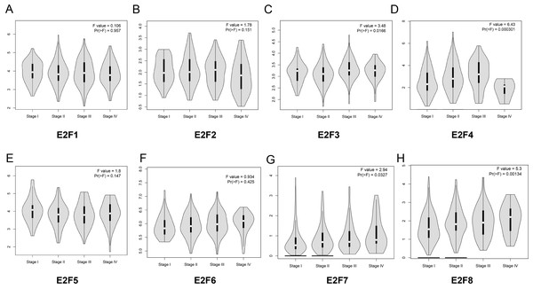 The relationship between the level of E2F genes and tumor stages in patients with colon cancer.