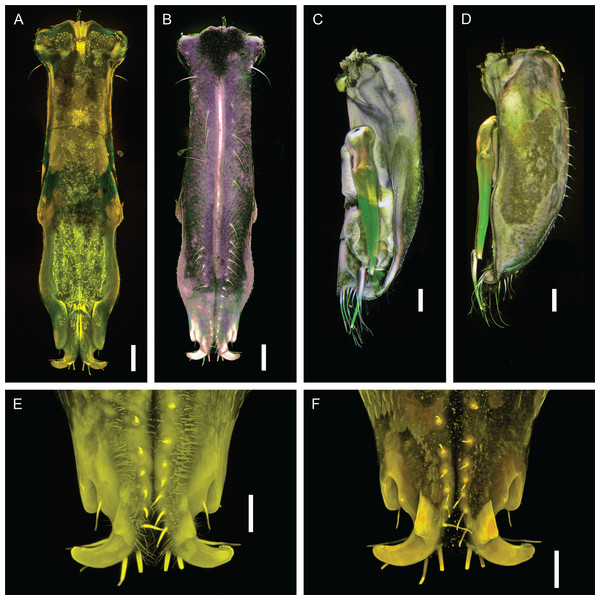 Macrostylis metallicola n. sp. paratype ♂ 1242 (SMF 50942), confocal laser scanning microscopy (cLSM) images.