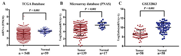 The mRNA expression level of FGL2 in lung adenocarcinoma.