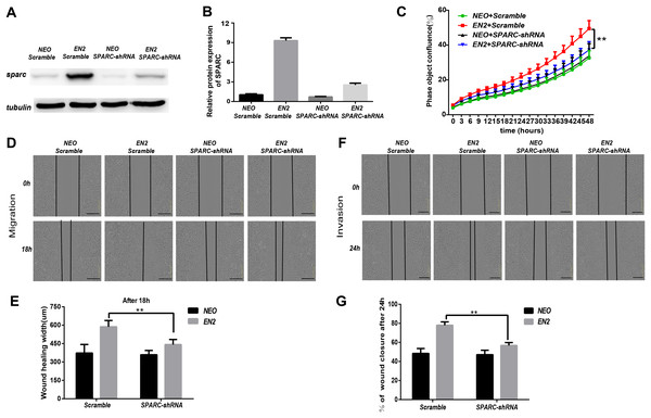 ShRNA-mediated knockdown of SPARC hampers the pro-oncogenic effect of EN2.