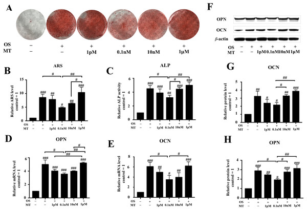 Effect of MT on osteogenic differentiation of hPDLSCs.