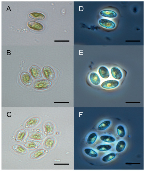 Microscopy of Granulocystopsis sp.