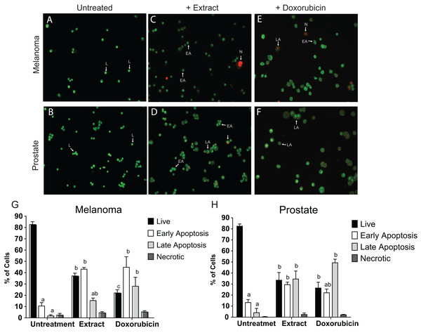 AO/EB double stain of human cancer cell lines after a treatment with microalgal extract.