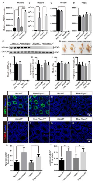 Analysis of testis and sperm in Hspa1l−∕− mice after heat stress.