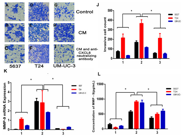 TAM-like PBM-derived macrophages increase the invasiveness of bladder cancer cells through CXCL8.