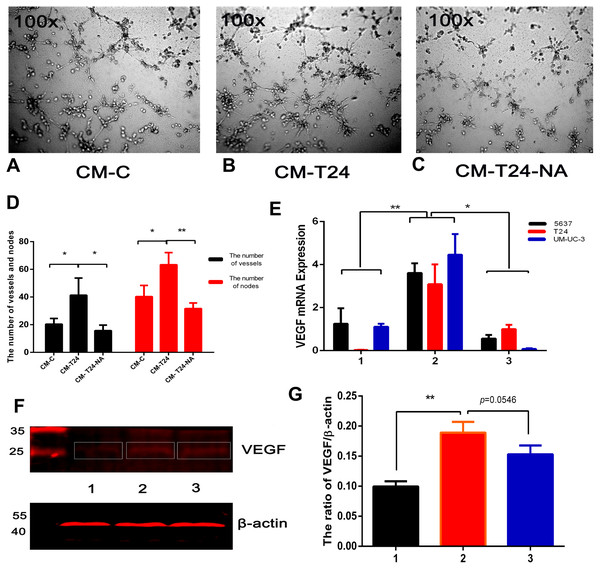 CXCL8-derived TAM-like PBM-derived macrophagespromote the pro-angiogenic ability of bladder cancer cells.