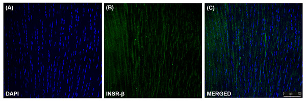 Immunofluorescence of insulin receptor beta (INSR-β) in the human Achilles tendon captured with a confocal laser scanning microscope.