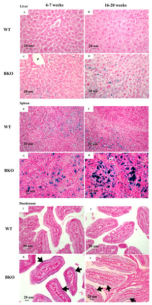 Iron accumulation in the tissues of BKO mice.