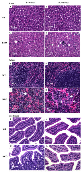 Hematopoietic and mononuclear cell infiltration in the liver and spleen of BKO mice.