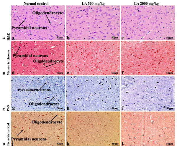 Microscopic analysis of brain tissues of female SD rats in acute oral toxicity study, presenting normal morphology after single oral doses of LA (300 mg/kg and 2,000 mg/kg).