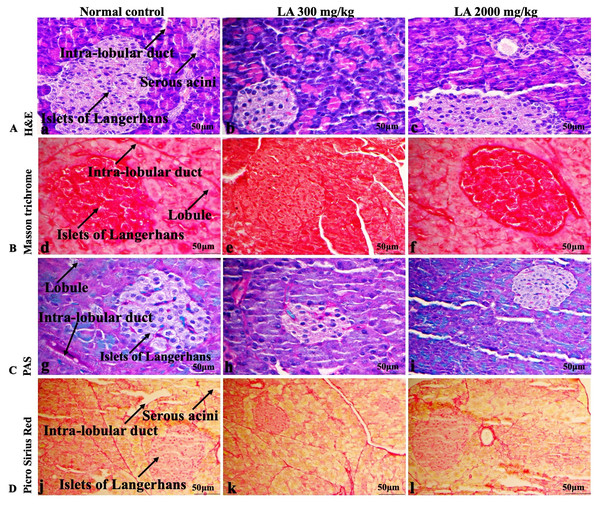 Microscopic analysis of pancreas tissues of female SD rats in acute oral toxicity study, presenting normal morphology after single oral doses of LA (300 mg/kg and 2,000 mg/kg).