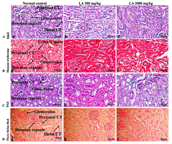 Microscopic analysis of kidney tissues of female SD rats in acute oral toxicity study, presenting normal morphology after single oral doses of LA (300 mg/kg and 2,000 mg/kg).