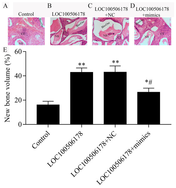 LOC100506178 increases in vivo ectopic bone formation in hBMSCs by suppression miR-214-5p.