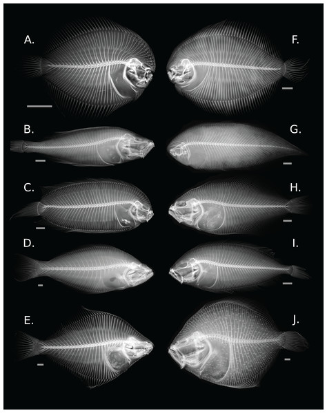 Diversity of skeletal morphology in the flatfishes.