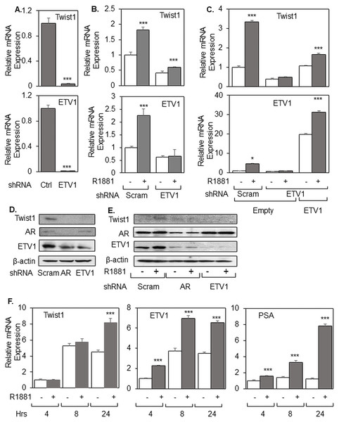 ETV1 is required for androgen-induced expression of Twist1.