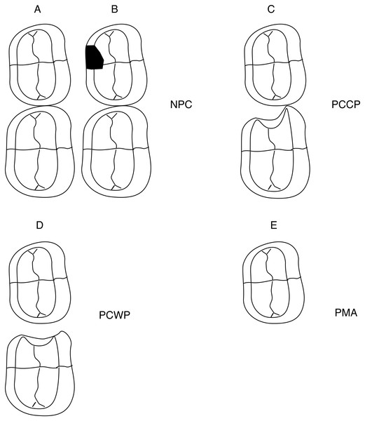 Ilustration to describe different primary molars carious conditions and the groups of the primary molar status.