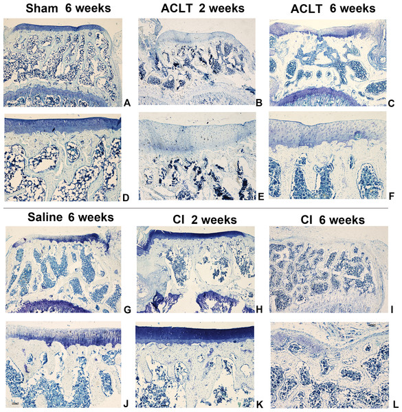 The histological assessment (toluidine blue) of the ACLT and CI group.