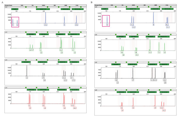 Amplification products of a male (A) and a female (B), detected by an ABI 3500 genetic analyzer.