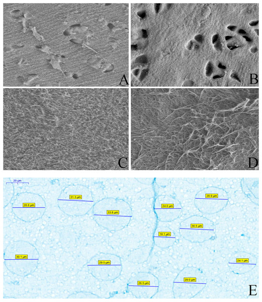 The scanning electron microscope results of cartilage and the evaluation of particles.