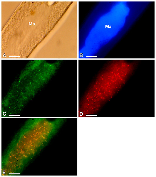 Results of FISH experiments on a P. multimicronucleatum US_Bl 16I1 cell.