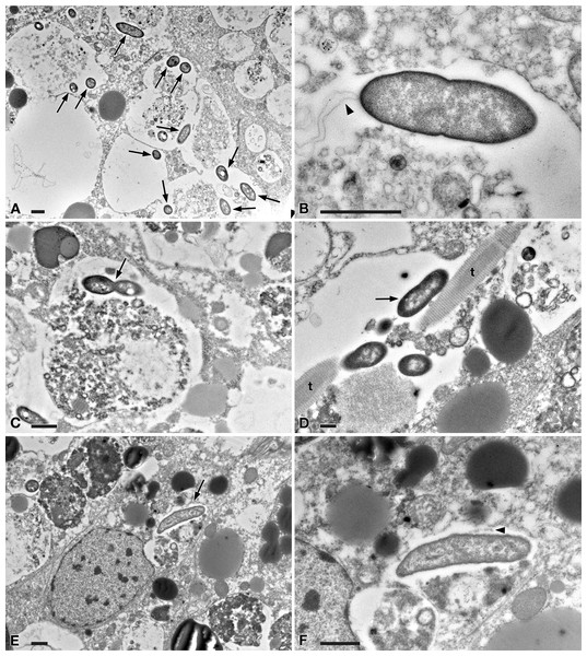 TEM pictures of the intestine of antibiotic-treated D. japonica fed on liver paste enriched with the homogenate of P. multimicronucleatum US_Bl 16I1 cells and fixed at day 1 after feeding.