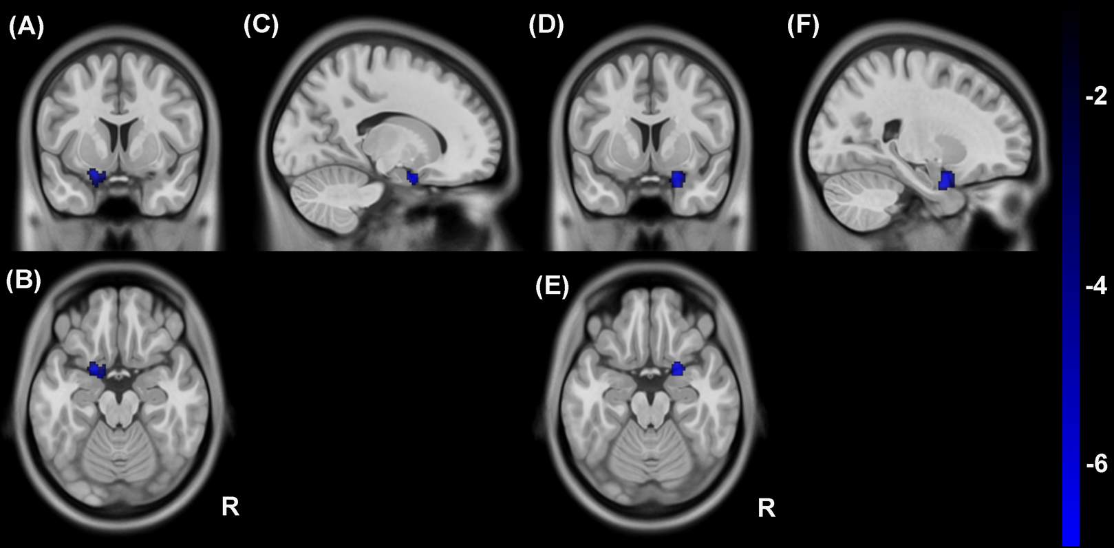 Disturbed neurovascular coupling in hemodialysis patients [PeerJ]