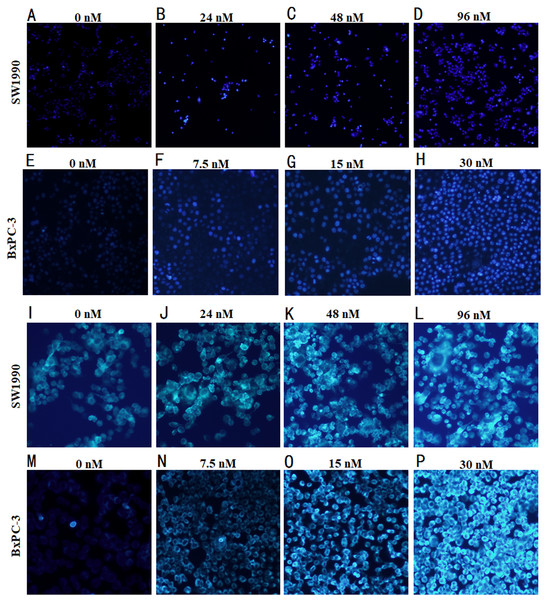 Morphological detection of apoptosis and autophagy in cells by immunofluorescence.