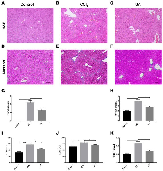 Effect of UA on liver injury and fibrosis in mice with liver fibrosis.