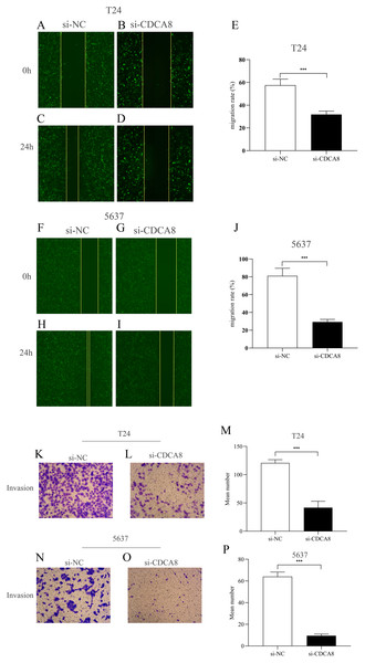 Effect of CDCA8 knockdown on the migration and invasion of bladder cancer cells.