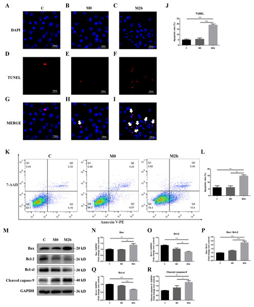 Conditioned medium from M2b macrophages attenuated the apoptosis resistance of PASMCs.