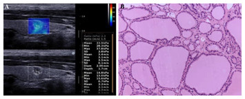 Multimode Ultrasonic Technique Is Recommended For The Differential ...