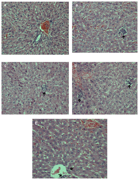 (A–E): Photomicrographs of liver sections in rats treated with methanolic extract of A. africanus (H&E stain, magnification ×100).
